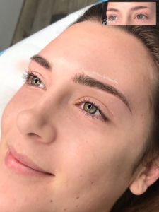 Microblading